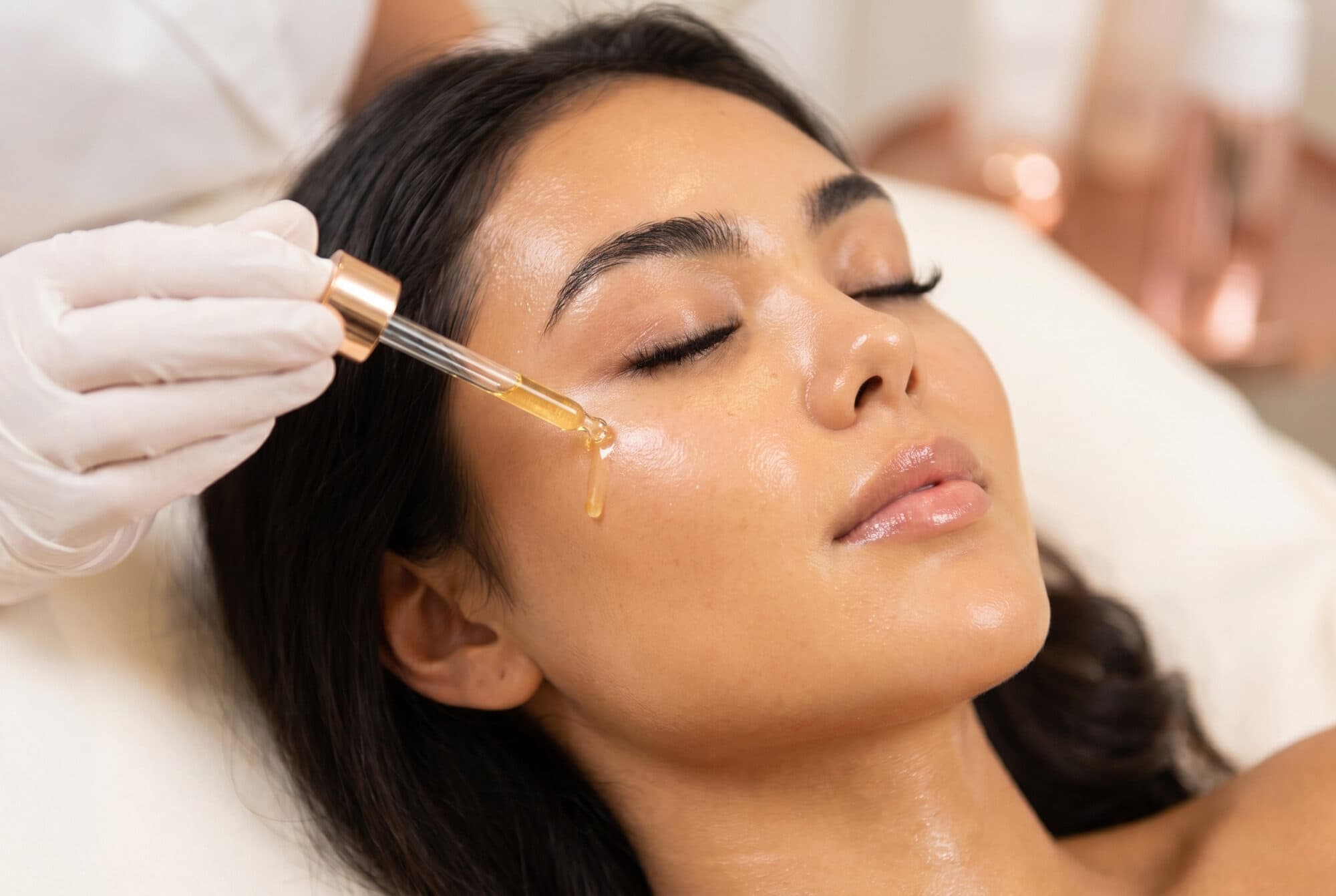 Microneedling with PDRN (salmon DNA therapy)
