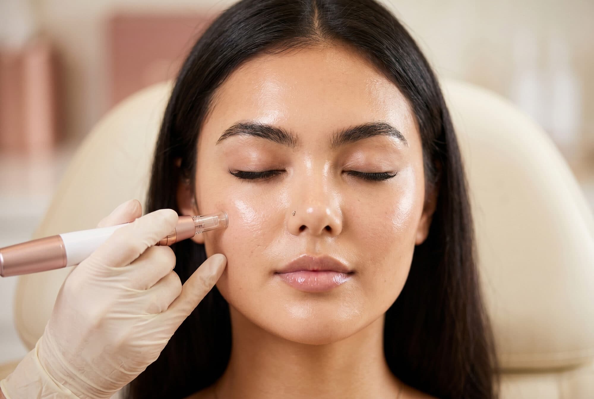 Microneedling (collagen induction therapy)